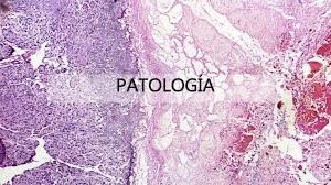 Patología