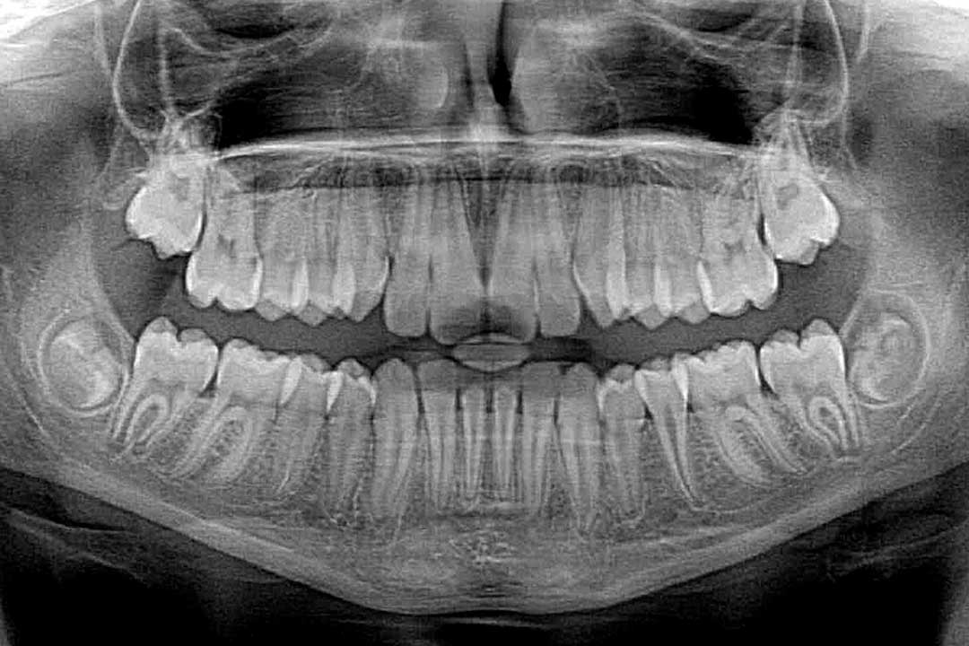 Radiología