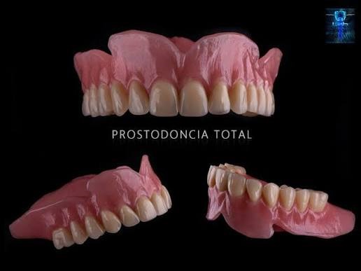 Prostodoncia